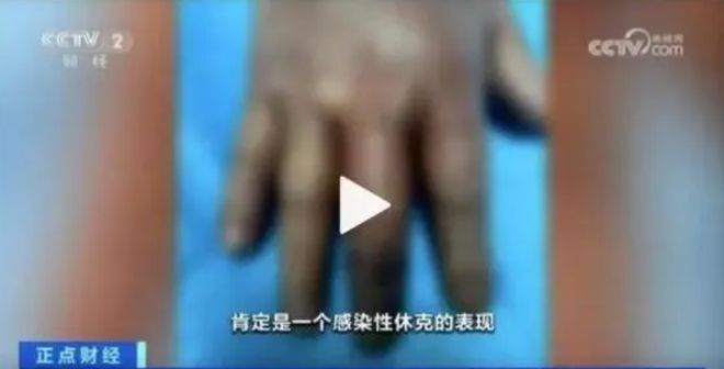 网传“深圳一公园螃蟹抓不完”？官方回应(图2)