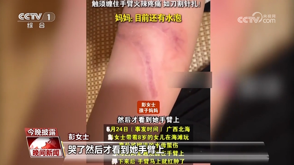 守护儿童假期安全 这些知识要牢记(图4)